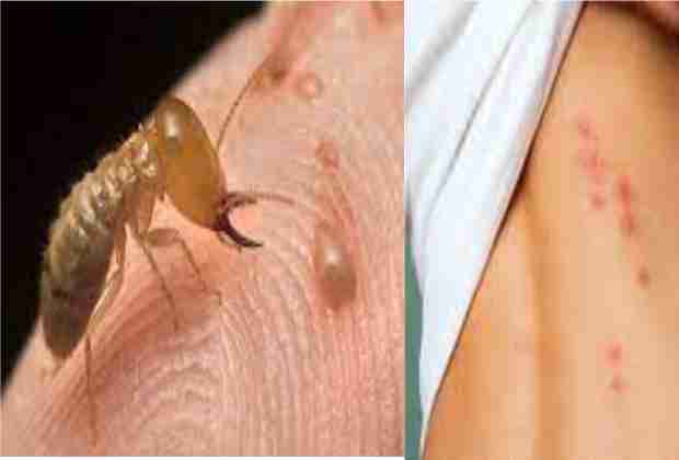 Mối cắn có độc không?